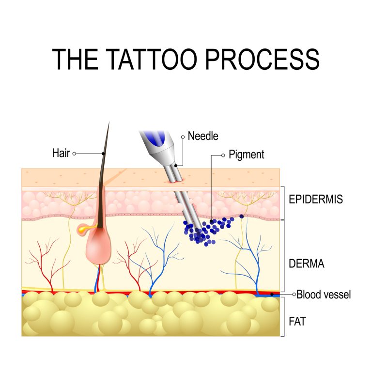 Paramedical Tattooing